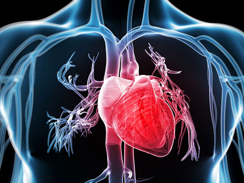 آنژیوگرافی-قلب-