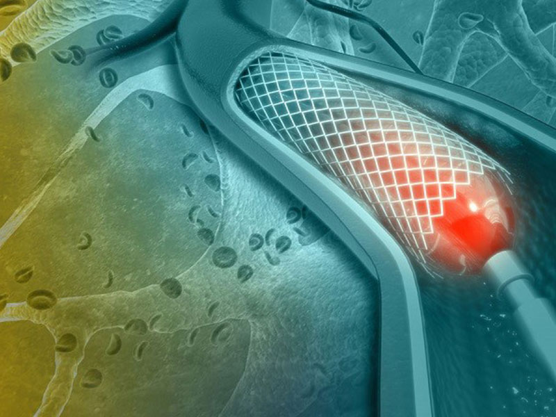 بالن-زدن-قلب-