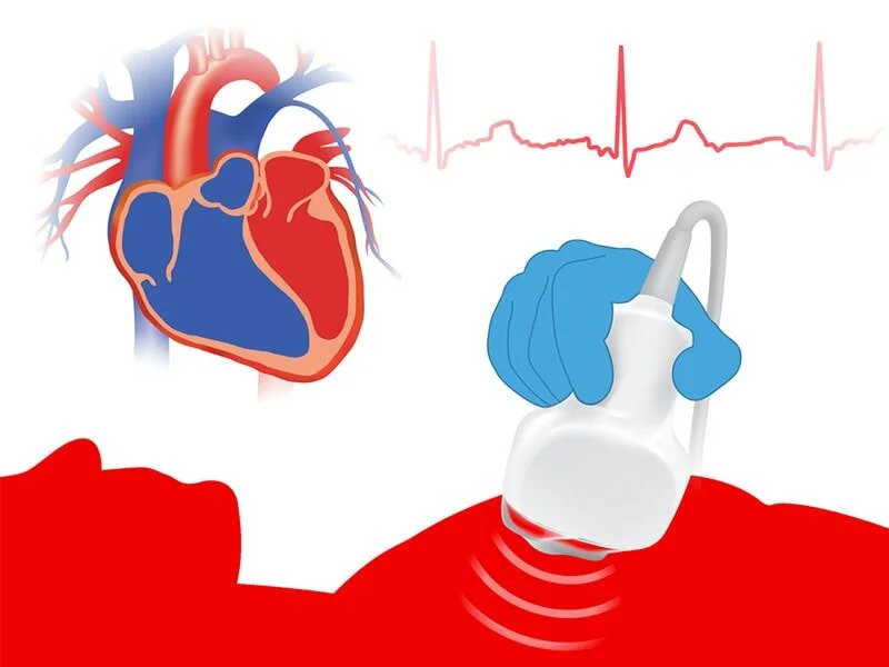 تصویربرداری-از-قلب-