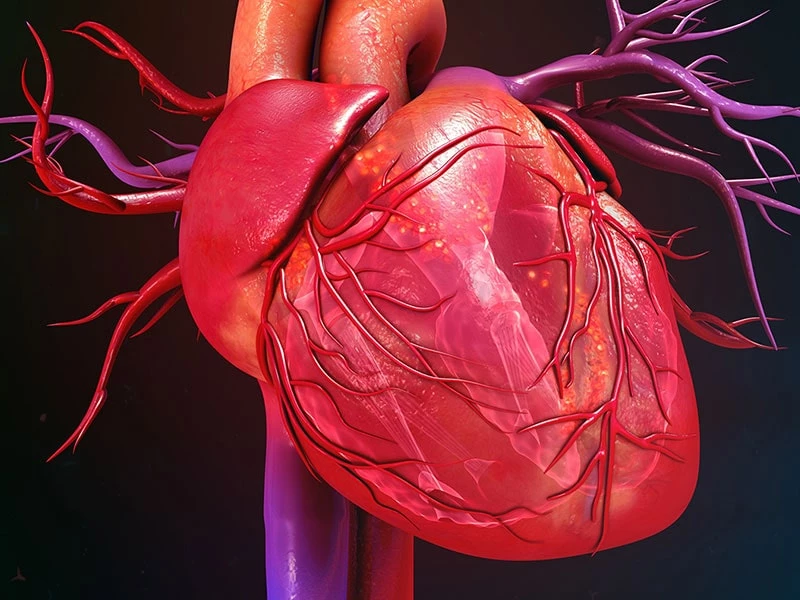 بیماری التهاب عضله قلب یا کاردیومیوپاتی