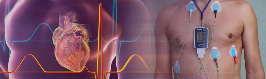 دستگاه هولتر مانیتورینگ