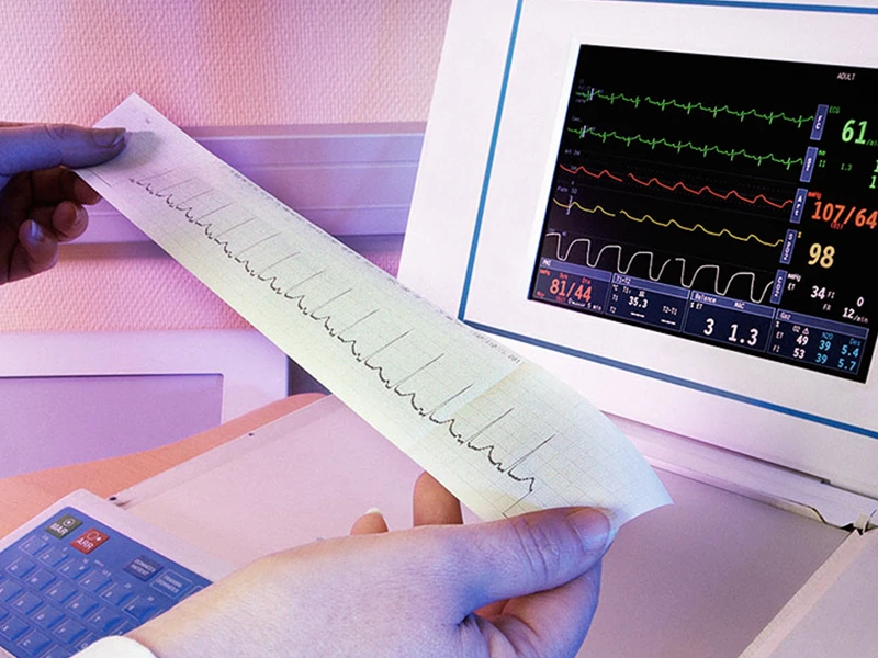 تست-نوار-قلبی