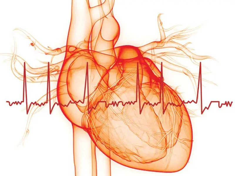 فیبریلاسیون دهلیزی