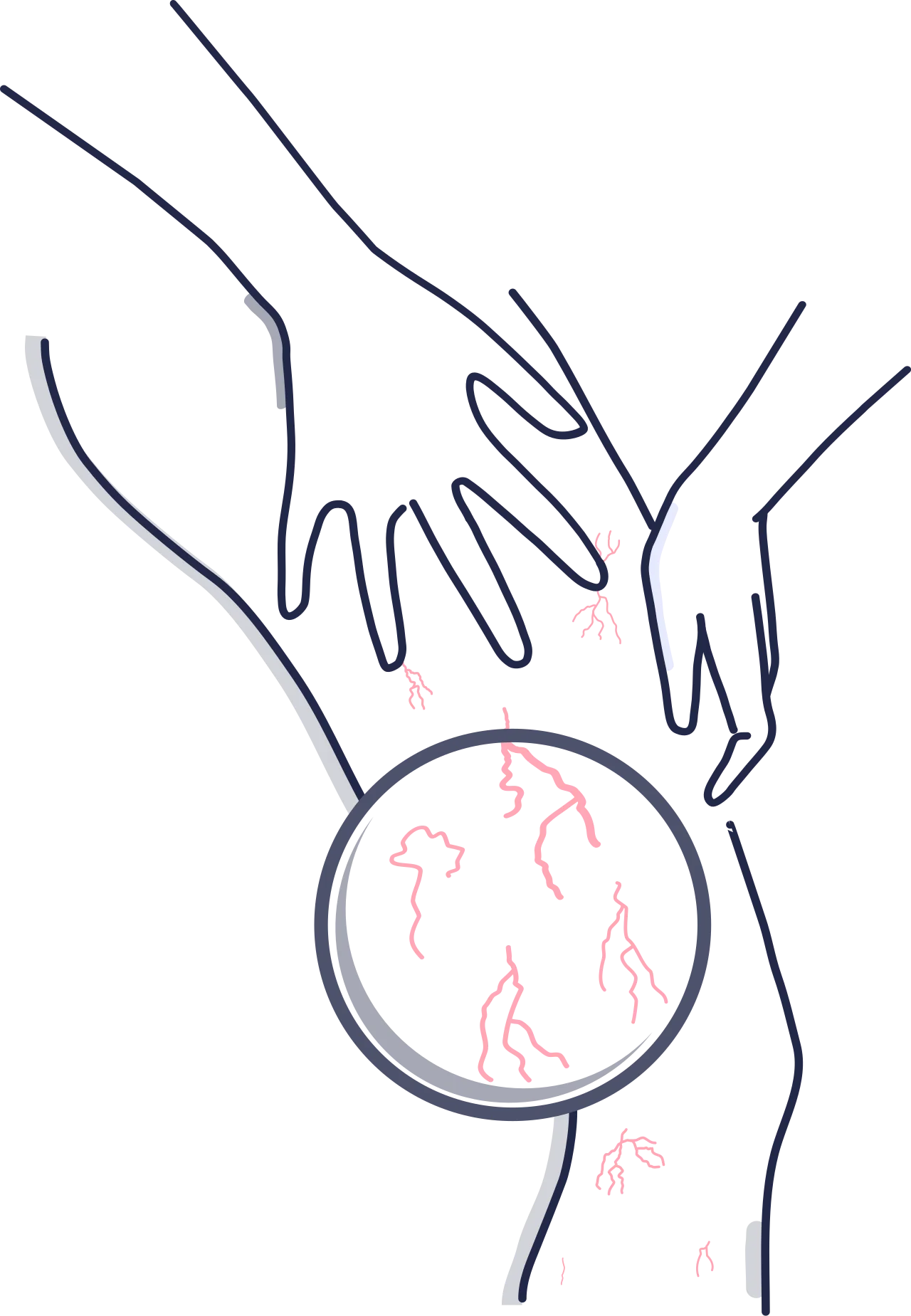 عروق-واریسی-پا